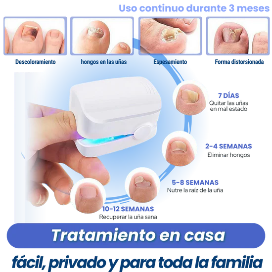 Elimina los Hongos de las Uñas de Raíz con Tecnología Láser en Casa.