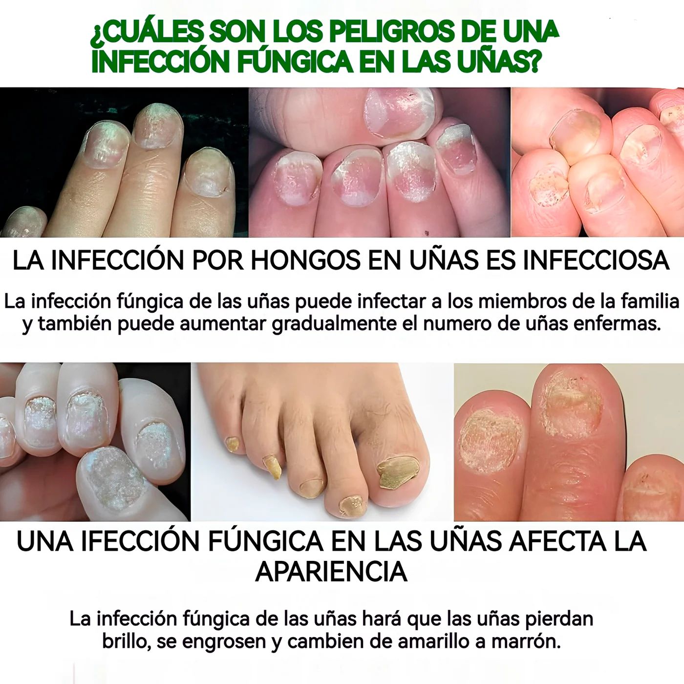 ✨Jaysuing 7 Days Serum: Despídete de los hongos y luce uñas perfectas 💅