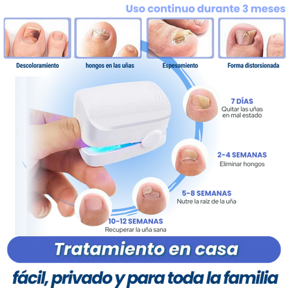Elimina los Hongos de las Uñas de Raíz con Tecnología Láser en Casa.