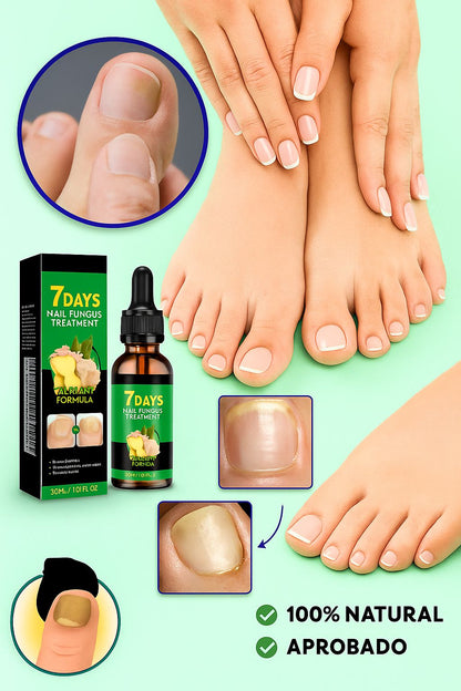 ✨Jaysuing 7 Days Serum: Despídete de los hongos y luce uñas perfectas 💅