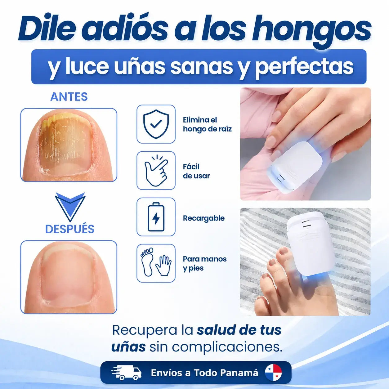 Elimina los Hongos de las Uñas de Raíz con Tecnología Láser en Casa.