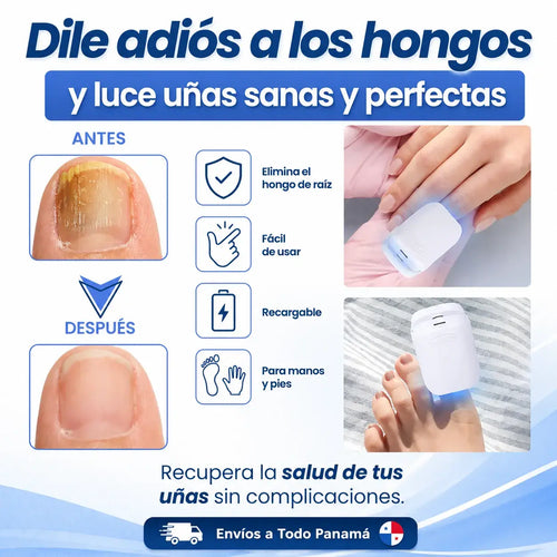 Elimina los Hongos de las Uñas de Raíz con Tecnología Láser en Casa.