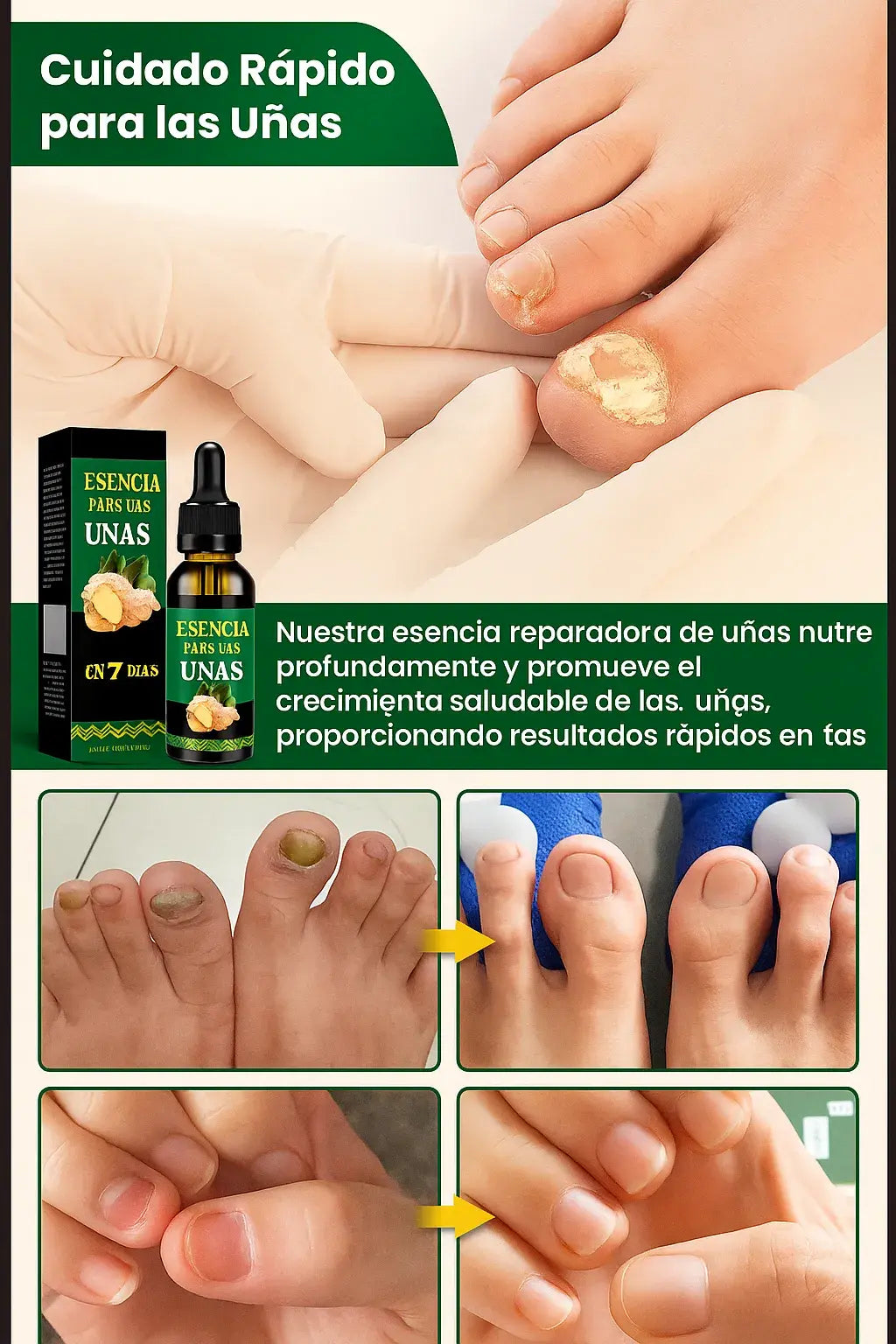 ✨Jaysuing 7 Days Serum: Despídete de los hongos y luce uñas perfectas 💅